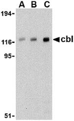 c-Cbl Antibody in Western Blot (WB)