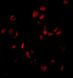 SUMO1 Antibody in Immunocytochemistry (ICC/IF)