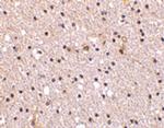 Nicastrin Antibody in Immunohistochemistry (IHC)