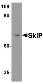 SNW1 Antibody in Western Blot (WB)