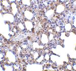 Blimp-1 Antibody in Immunohistochemistry (IHC)