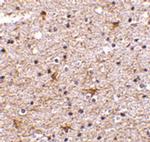 TMP21 Antibody in Immunohistochemistry (IHC)