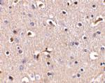 APH1 Antibody in Immunohistochemistry (IHC)