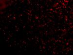 ORAI1 Antibody in Immunocytochemistry (ICC/IF)