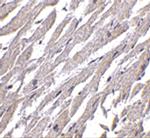 CRTH2 Antibody in Immunohistochemistry (IHC)