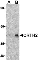 CRTH2 Antibody in Western Blot (WB)