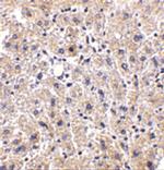 DRAM Antibody in Immunohistochemistry (Paraffin) (IHC (P))