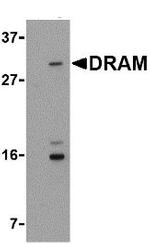 DRAM Antibody in Western Blot (WB)