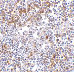 MDA5 Antibody in Immunohistochemistry (IHC)