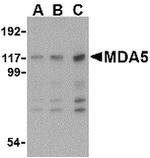 MDA5 Antibody in Western Blot (WB)