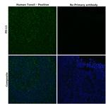 PD-L1 Antibody in Immunohistochemistry (Paraffin) (IHC (P))