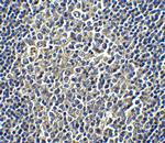 PD-L1 Antibody in Immunohistochemistry (Paraffin) (IHC (P))