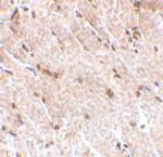 MAPKAP1 Antibody in Immunohistochemistry (IHC)