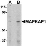 MAPKAP1 Antibody in Western Blot (WB)