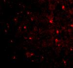 Nogo-A Antibody in Immunohistochemistry (IHC)