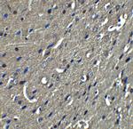 Nogo-A Antibody in Immunohistochemistry (IHC)