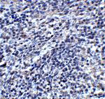 ORAI3 Antibody in Immunohistochemistry (IHC)