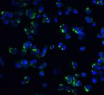 STIM1 Antibody in Immunohistochemistry (IHC)