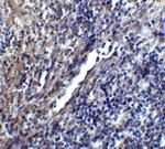 STIM1 Antibody in Immunohistochemistry (IHC)