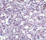 STIM2 Antibody in Immunohistochemistry (IHC)