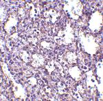 STIM2 Antibody in Immunohistochemistry (IHC)