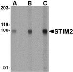 STIM2 Antibody in Western Blot (WB)