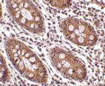 p16INK4a Antibody in Immunohistochemistry (Paraffin) (IHC (P))