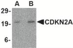 p16INK4a Antibody in Western Blot (WB)