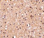 Stathmin 1 Antibody in Immunohistochemistry (Paraffin) (IHC (P))