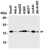 Stathmin 1 Antibody in Western Blot (WB)