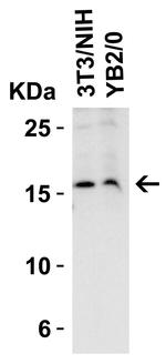 Stathmin 1 Antibody in Western Blot (WB)