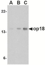 Stathmin 1 Antibody in Western Blot (WB)