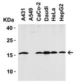 Stathmin 1 Antibody in Western Blot (WB)