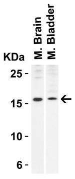 Stathmin 1 Antibody in Western Blot (WB)