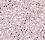 TACR3 Antibody in Immunohistochemistry (IHC)