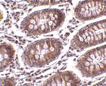 MICA Antibody in Immunohistochemistry (IHC)