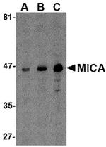 MICA Antibody in Western Blot (WB)