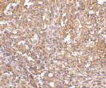 ORAI1 Antibody in Immunohistochemistry (IHC)