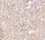 STEAP1 Antibody in Immunohistochemistry (IHC)