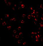 TRIM25 Antibody in Immunocytochemistry (ICC/IF)