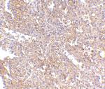 RAP80 Antibody in Immunohistochemistry (IHC)