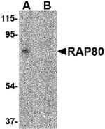 RAP80 Antibody in Western Blot (WB)