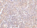 RAP80 Antibody in Immunohistochemistry (IHC)