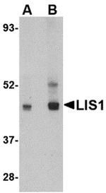 LIS1 Antibody in Western Blot (WB)