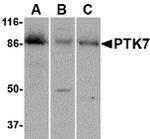 PTK7 Antibody in Western Blot (WB)