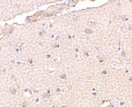 BRCC3 Antibody in Immunohistochemistry (IHC)