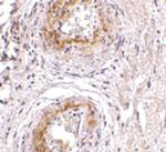 TEM5 Antibody in Immunohistochemistry (IHC)