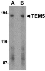 TEM5 Antibody in Western Blot (WB)