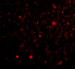 TOCA-1 Antibody in Immunocytochemistry (ICC/IF)