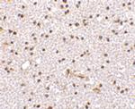 TOCA-1 Antibody in Immunohistochemistry (IHC)